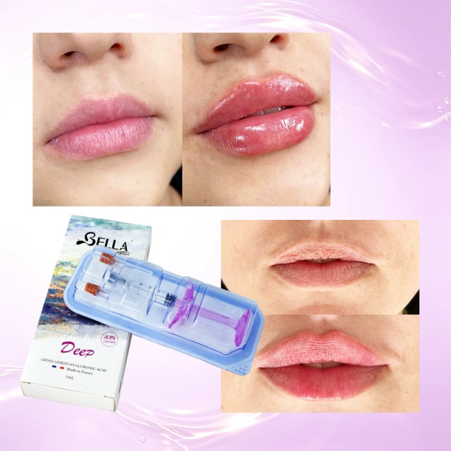 ژل بلا دیپ ده سی سی فرانسوی bella deep لب وکانتورینگ